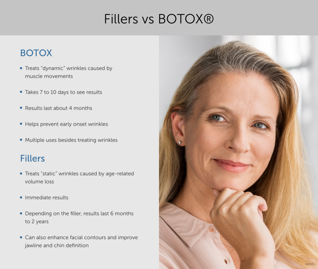 Fillers vs Botox infographic