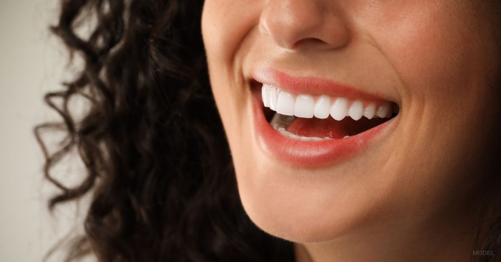 A close-up of a woman's smile. (Model)